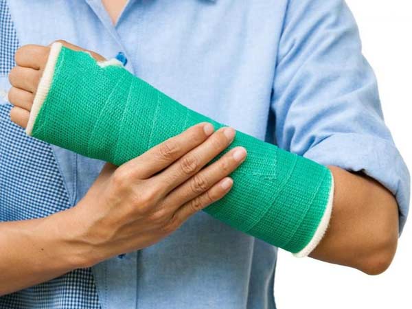 fracture treatment in Dwarka