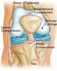 knee replacement surgery in Delhi